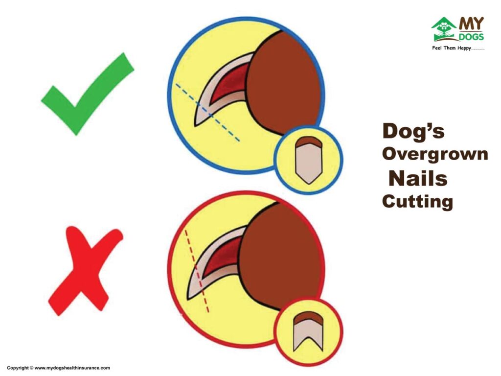 Overgrown Nails Clipping